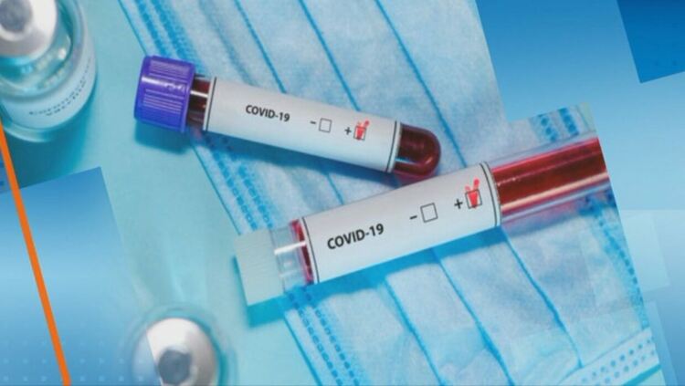 40 нови случаи на COVID-19 са регистрирани през уикенда в Пернишка област
