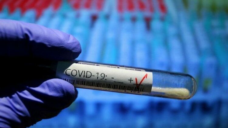 41 са починалите с COVID-19 в област Пловдив само за денонощие 